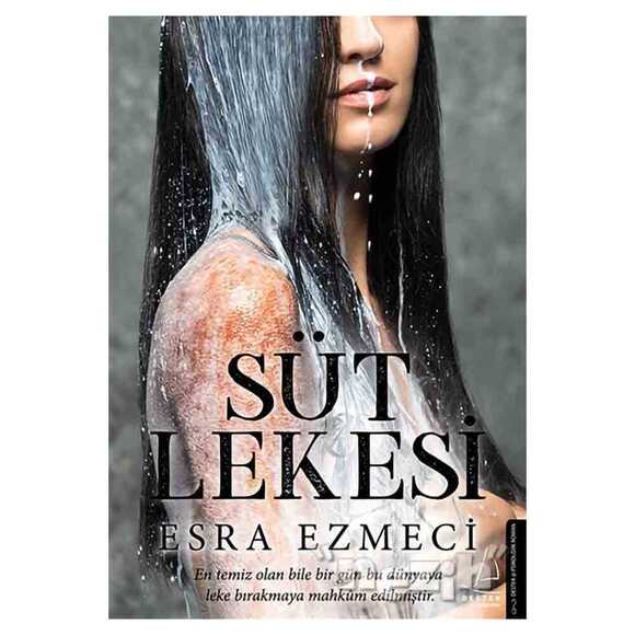 Süt Lekesi